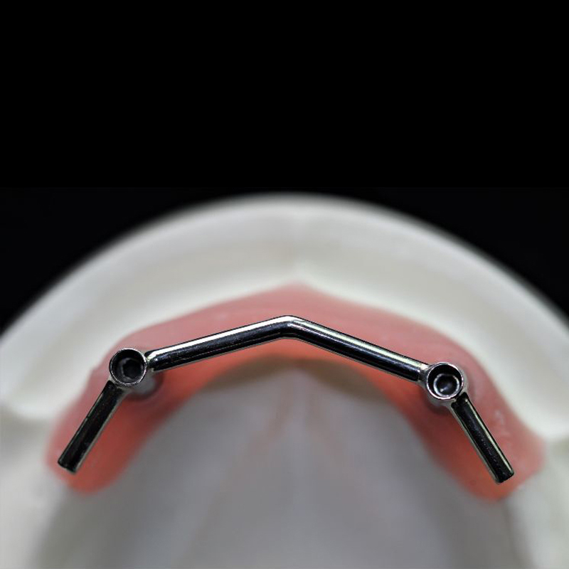 Implantatstang