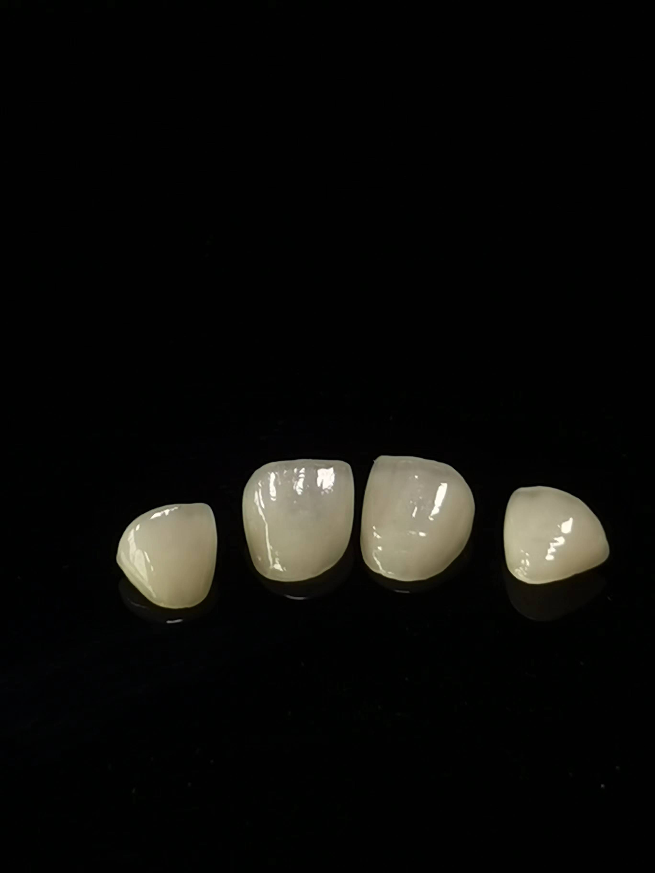 E.max Dental lab Arbejde