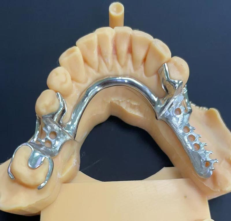 Fordele ved Cobalt-Chromium Framework (Co Cr Framework)