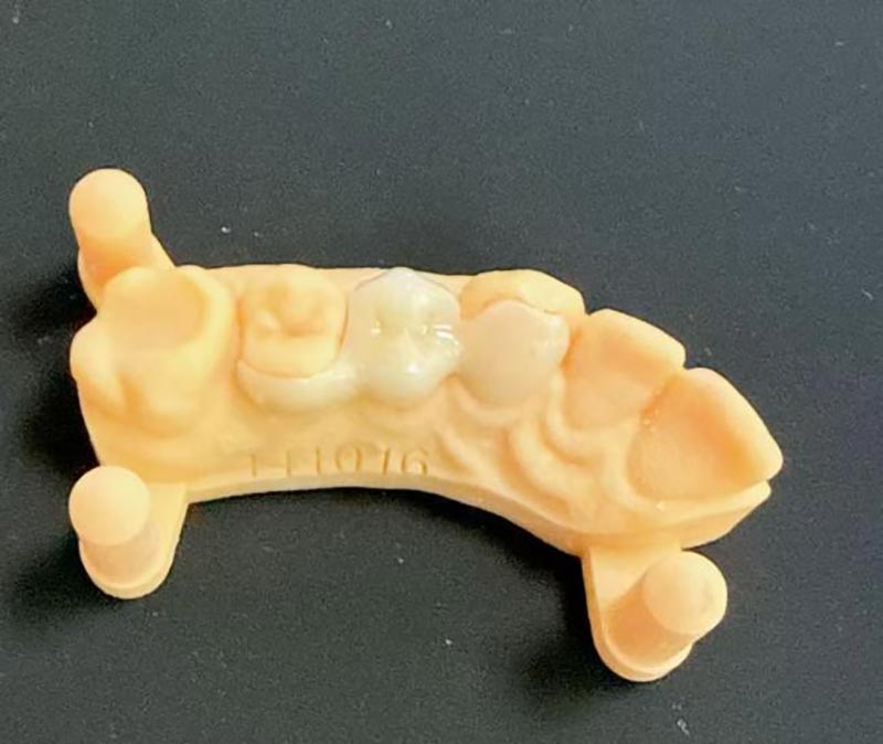 Hvad du behøver at vide om Maryland Bridges?