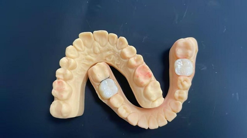 Hvad er skulderkanten?