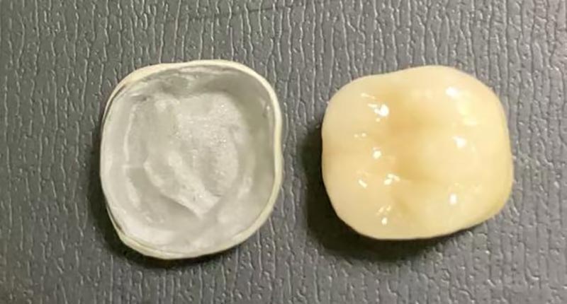 WM DENTAL LAB – Et førende kinesisk tandlægelaboratorium