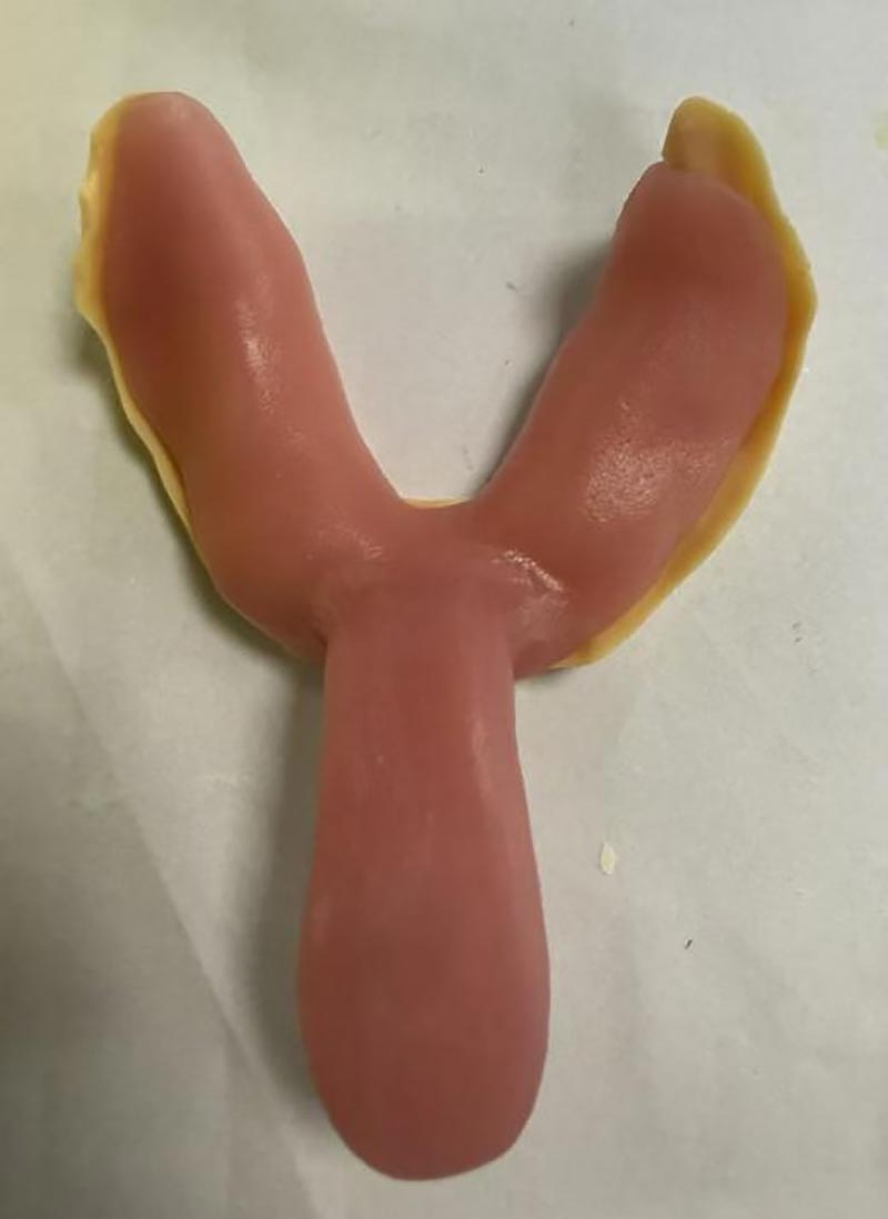 Ting du ikke vidste om brugerdefinerede tandbakker