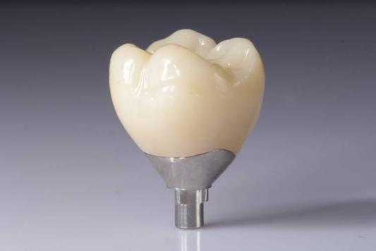 Optimer dine resultater med zirconia-restaureringer (kroner, broer, implantater)