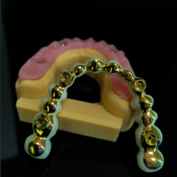 All On 4 Hybrid Bridge - Fuld Zirconia Bridge over Titanium Bar