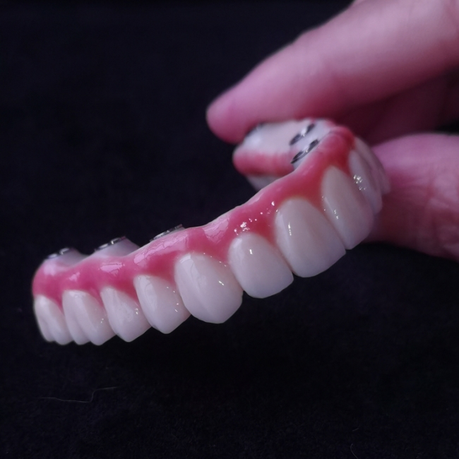 All On X Hybrid Bridge - Fuld Zirconia Bridge over Tibases