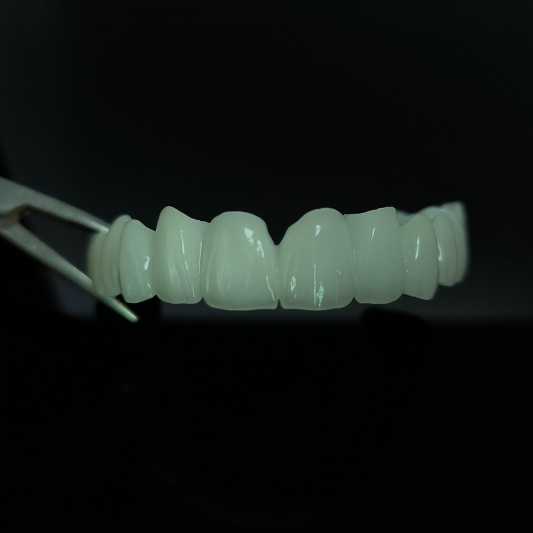 High Translucent Zirconia Bridge Layered Zirconia Kina Dental lab arbejde