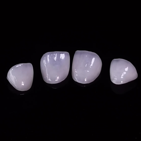 Hight Translucent Dental Finer Layered Emax Finer Dental lab arbejde