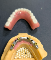 Locator og tandstang